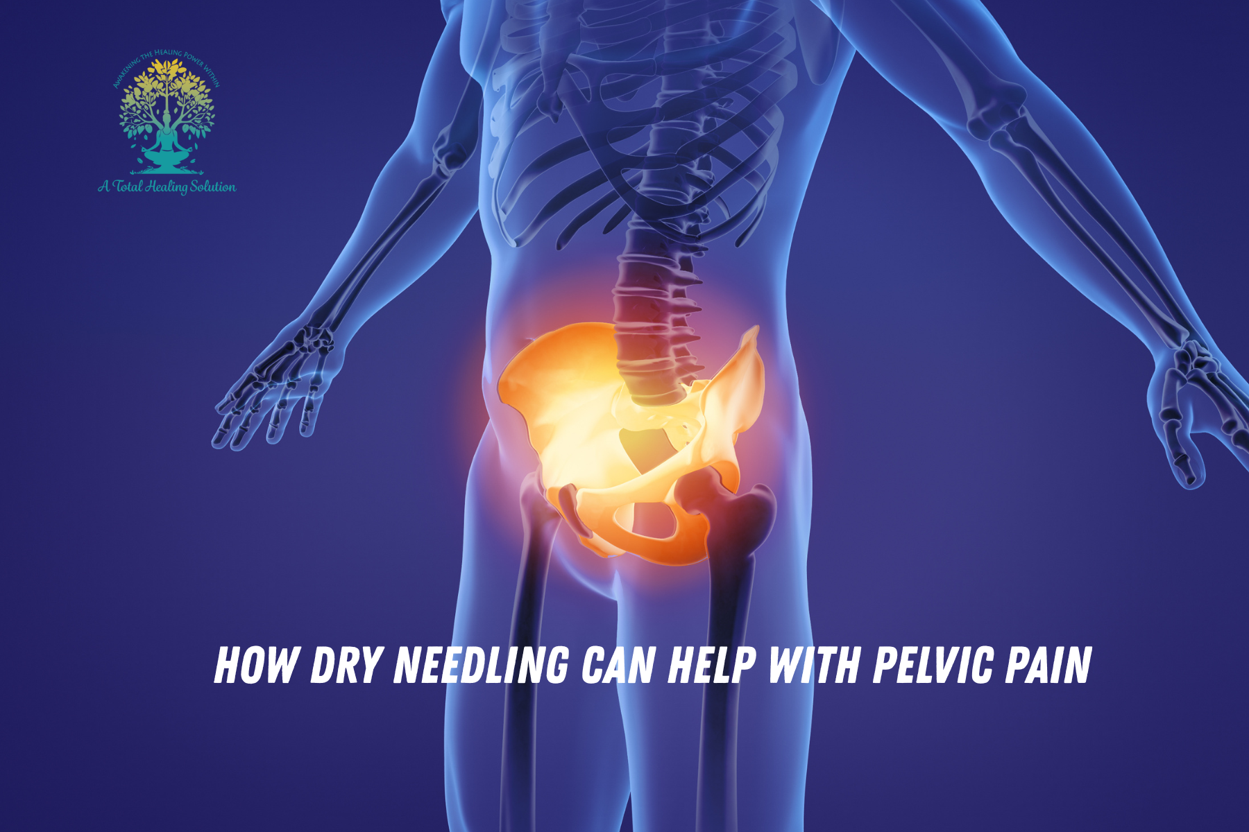 Do you Have Pelvic Pain, & Want to Know if Dry Needling Can Help? Dyspareunia Relief, Help with Painful Intercourse