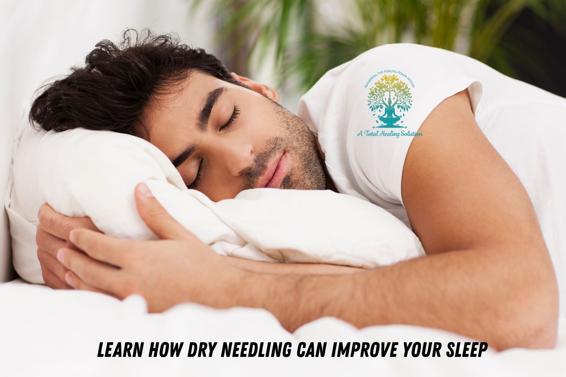 How Dry Needling Can Help with Sleep