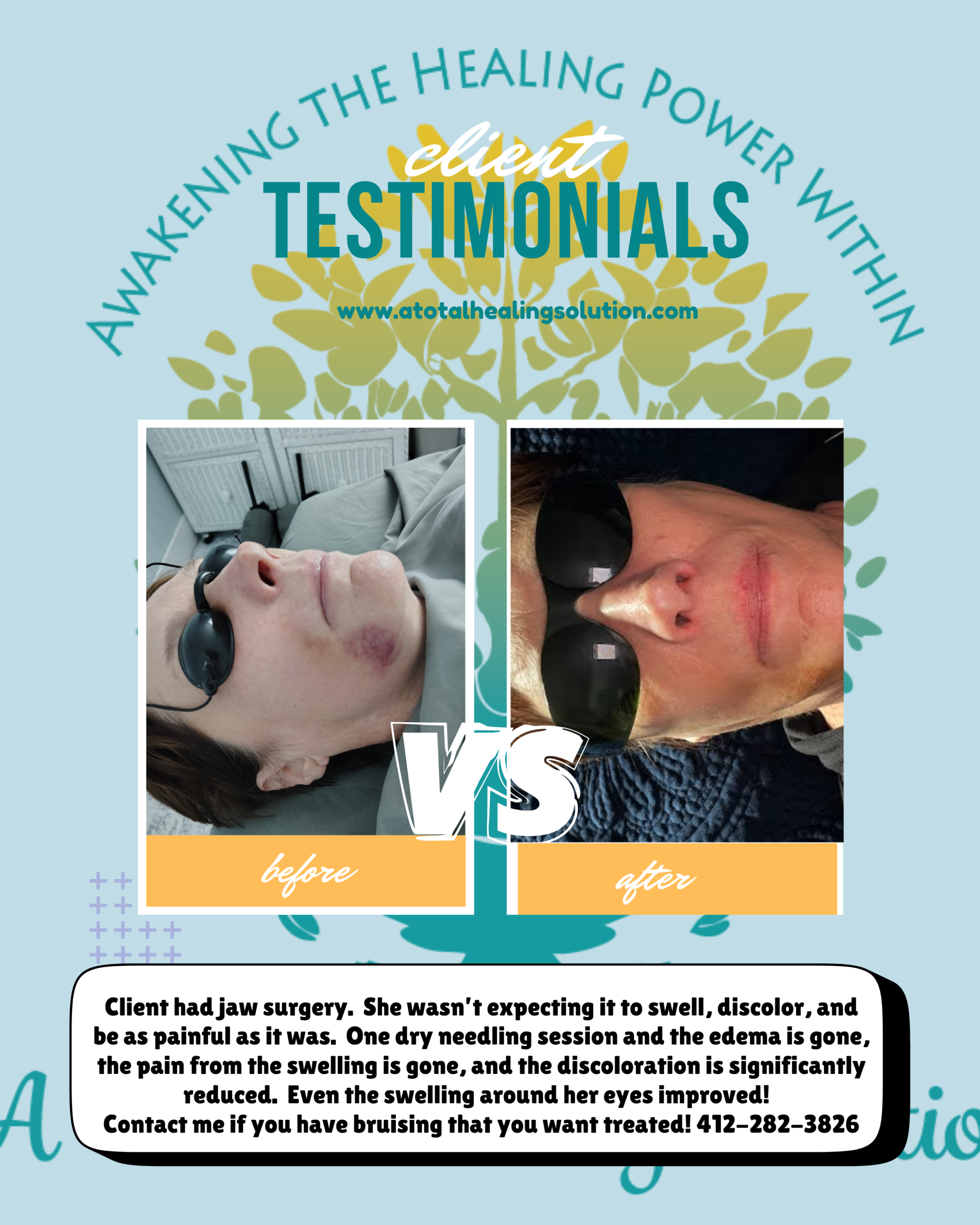 Trauma After Surgery?