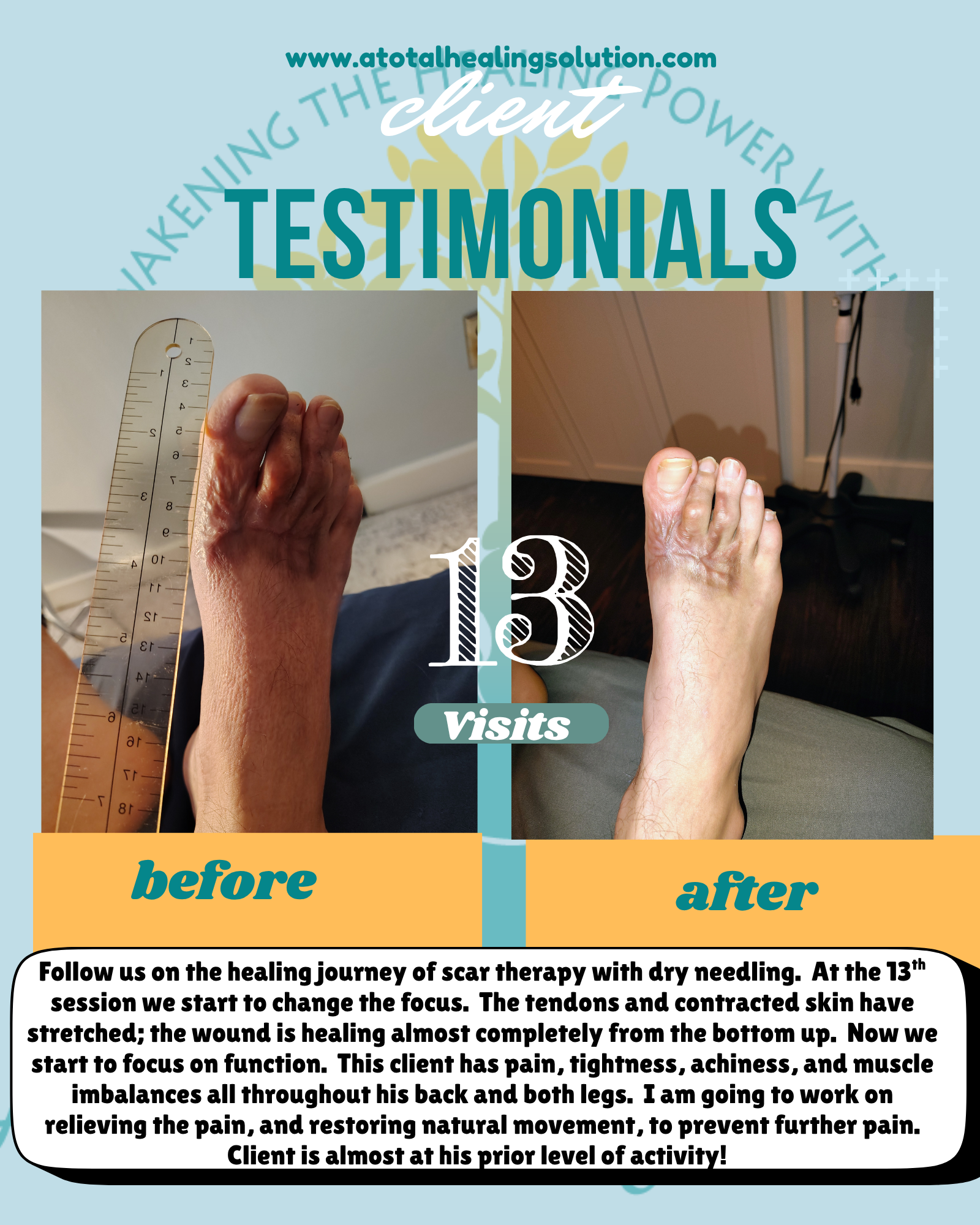 Scar Therapy Journey Visit 13